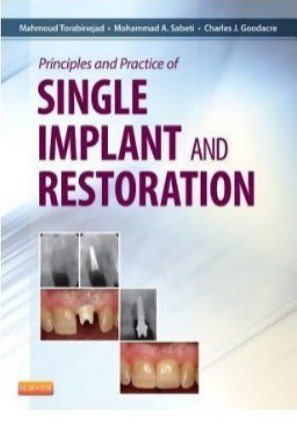 Principles and Practice of Single Implant and Restoration PDF Free Download