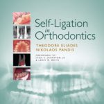 Self-Ligation in Orthodontics PDF Free Download