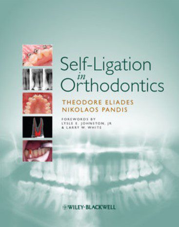Self-Ligation in Orthodontics PDF Free Download