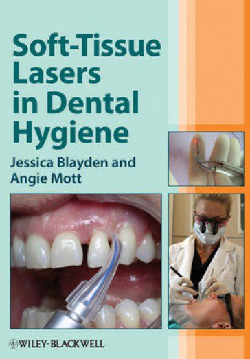 Soft-Tissue Lasers in Dental Hygiene PDF Free Download
