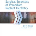 Surgical Essentials of Immediate Implant Dentistry PDF Free Download