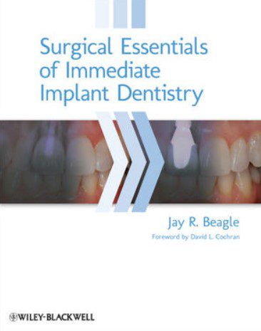 Surgical Essentials of Immediate Implant Dentistry PDF Free Download