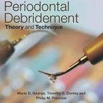 Ultrasonic Periodontal Debridement: Theory and Technique PDF Free Download