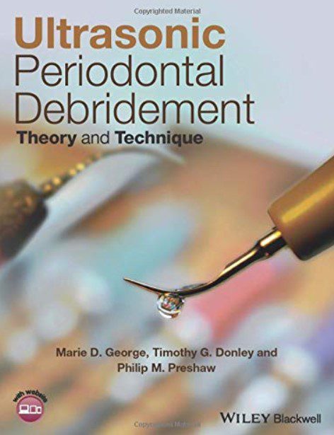 Ultrasonic Periodontal Debridement: Theory and Technique PDF Free Download