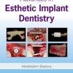 Advances in Esthetic Implant Dentistry PDF Free Download