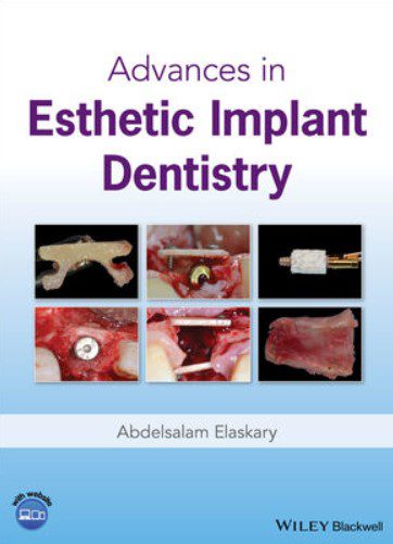 Advances in Esthetic Implant Dentistry PDF Free Download