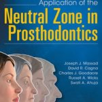 Application of the Neutral Zone in Prosthodontics PDF Free Download