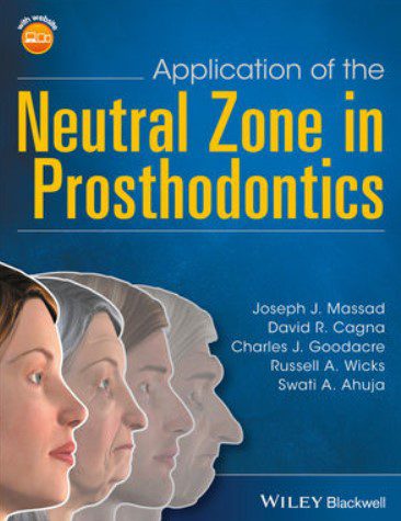 Application of the Neutral Zone in Prosthodontics PDF Free Download