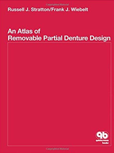 Atlas of Removable Partial Denture Design PDF Free Download