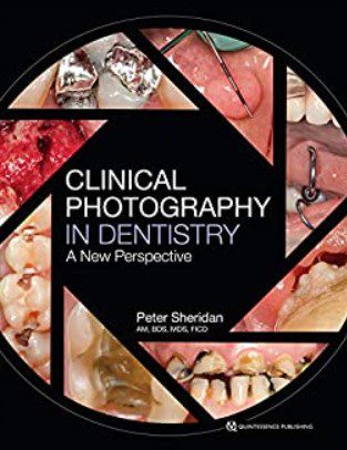 Clinical Photography in Dentistry A New Perspective PDF Free Download