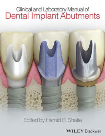 Clinical and Laboratory Manual of Dental Implant Abutments PDF Free Download