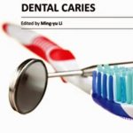 Contemporary Approach to Dental Caries PDF Free Download