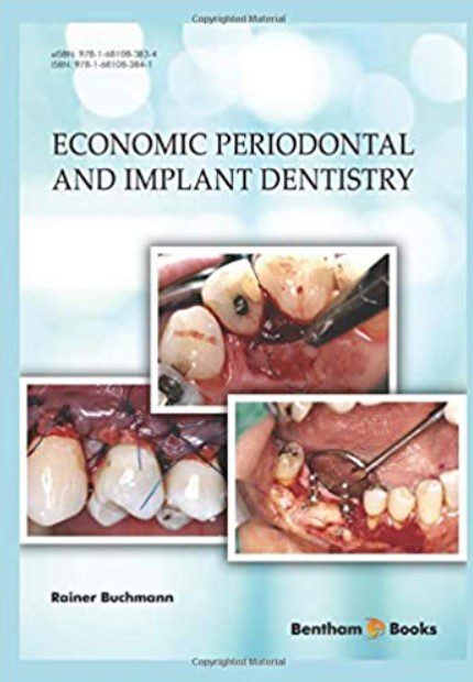 Economic Periodontal and Implant Dentistry PDF Free Download