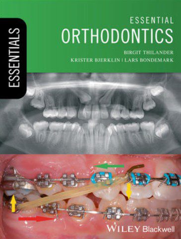 Essential Orthodontics PDF Free Download