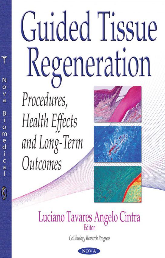 Guided Tissue Regeneration PDF Free Download