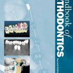 Handbook of Orthodontics 2nd Edition PDF Free Download