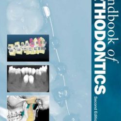 Handbook of Orthodontics 2nd Edition PDF Free Download Archives ...
