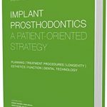 Implant Prosthodontics: A Patient-Oriented Strategy PDF Free Download