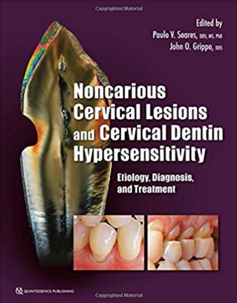 Noncarious Cervical Lesions and Cervical Dentin Hypersensitivity PDF Free Download