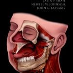 Oral Cancer PDF Free Download