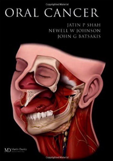 Oral Cancer PDF Free Download