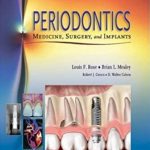 Periodontics: Medicine, Surgery, and Implants PDF Free Download