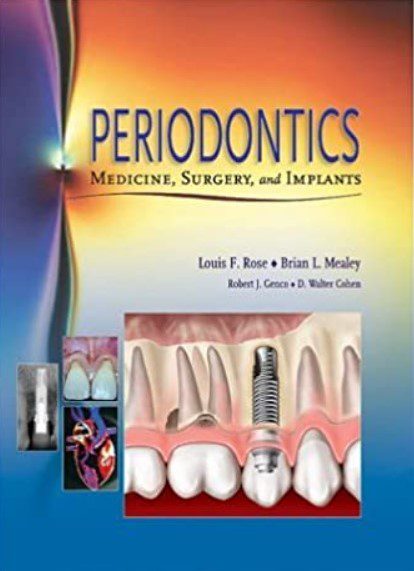 Periodontics: Medicine, Surgery, and Implants PDF Free Download