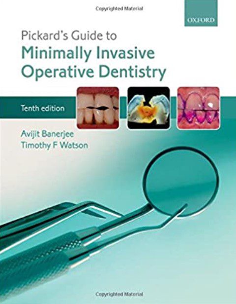 Pickard's Guide to Minimally Invasive Operative Dentistry 10th Edition PDF Free Download
