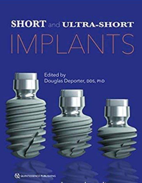 Short and Ultra-Short Implants PDF Free Download