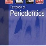 Textbook of Periodontics PDF Free Download