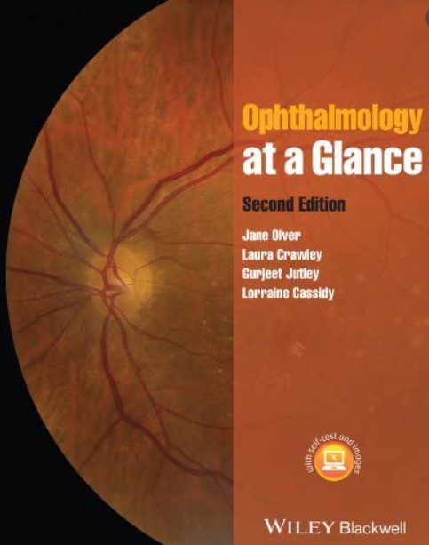 Ophthalmology at a Glance 2nd Edition PDF Free Download