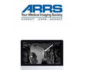 ARRS Women’s Imaging 2019 Videos Free Download