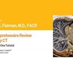 Download Expert Series with Elliot K. Fishman : A Comprehensive Review of Body CT 2021 Free