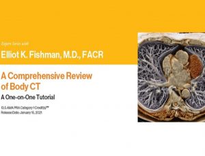 Download Expert Series with Elliot K. Fishman : A Comprehensive Review of Body CT 2021 Free
