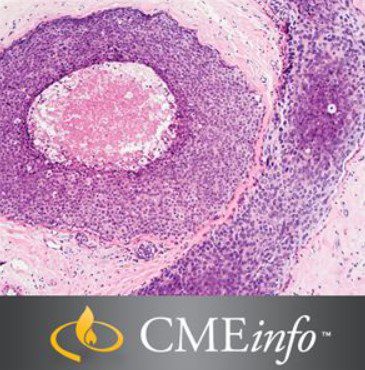 Download Masters of Pathology: Breast Pathology 2020 Videos and PDF Free