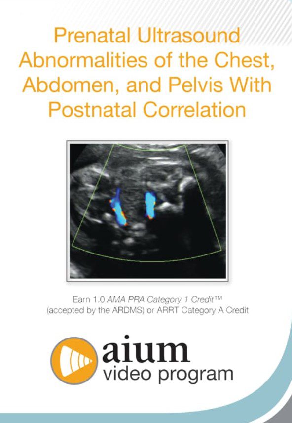 Download Prenatal Ultrasound Abnormalities of the Chest, Abdomen, and Pelvis With Postnatal Correlation Videos Free