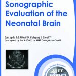 Download Sonographic Evaluation of the Neonatal Brain Videos Free