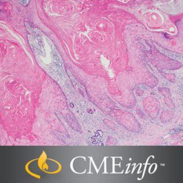Masters of Pathology: Dermatopathology 2020 Videos and PDF Free Download