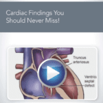 Download AIUM Cardiac Findings You Should Never Miss! Videos Free