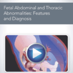 Download AIUM Fetal Abdominal and Thoracic Abnormalities: Features and Diagnosis Videos Free