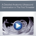 Download AIUM How to Perform a Detailed Anatomic Ultrasound Examination in the First Trimester Free