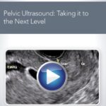 Download AIUM Pelvic Ultrasound: Taking it to the Next Level Videos Free