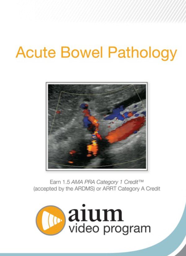 Download AIUM Point-of-Care Ultrasound Assessment of Acute Bowel Pathology Videos Free