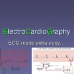 ECG Made Extra Easy PDF 2021 Free Download