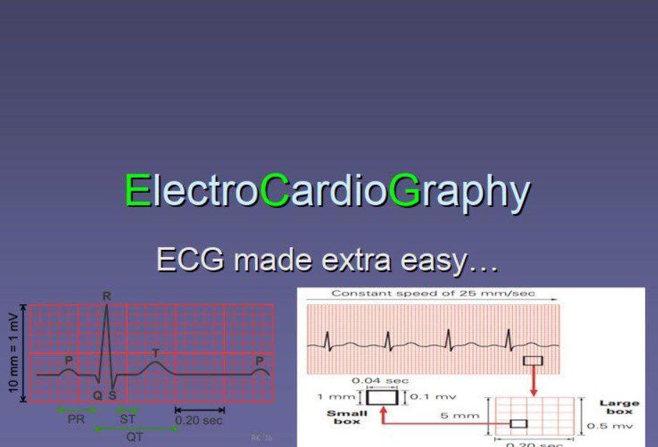 ECG Made Extra Easy PDF 2023 Free Download