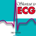 Shortcut to ECG First Edition PDF Free Download