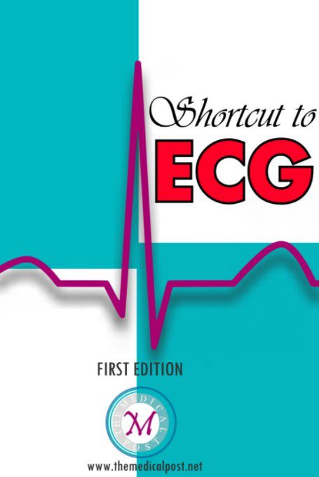 Shortcut to ECG First Edition PDF Free Download