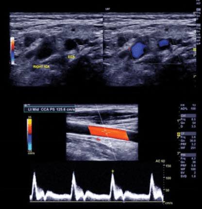 Download Clinical Approach to Vascular Ultrasound and RPVI Prep Course 2021 Free