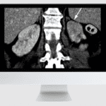 Abdominal and Thoracic Imaging Guidelines Applied: Evidence Versus Opinion 2021 Videos Free Download