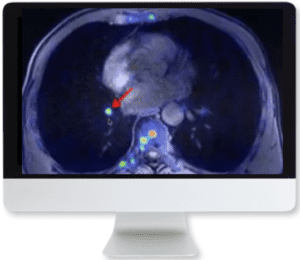 Applying Recent Advances in PET to Clinical Practice 2020 Videos Free Download